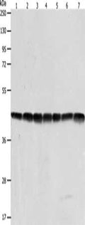 Gel: 10%SDS-PAGE, Lysate: 40 ug, Lane 1-7: Hela cells, Jurkat cells, NIH/3T3 cells, human fetal liver tissue, mouse brain tissue, A431 cells, 293T cells, Primary antibody: CSB-PA244513(ACTB Antibody) at dilution 1/600, Secondary antibody: Goat anti rabbit IgG at 1/8000 dilution, Exposure time: 7 seconds