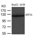 Western blot analysis of extracts from HepG2 and A549 cells using HIF2A  Antibody.