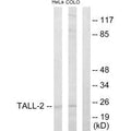 Western blot analysis of extracts from HeLa cells and COLO205 cells, using TALL-2 antibody.