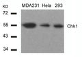 Western blot analysis of extracts from MDA231,Hela and 293 cells using Chk1(Ab-317) Antibody.