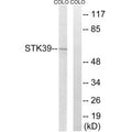 Western blot analysis of extracts from COLO cells, using STK39 antibody.