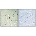 Immunohistochemistry analysis of paraffin-embedded human brain tissue using ABHD14B antibody.