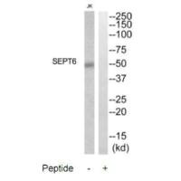 Western blot analysis of extracts from Jurkat cells, using SEPT6 antibody.