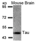 Western blot analysis of extracts from Mouse Brain tissue using Tau(Ab-205) Antibody.