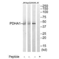 Western blot analysis of extracts from A549, HepG2 and Jurkat cells, using PDHA1 antibody.