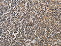 The image on the left is immunohistochemistry of paraffin-embedded Human tonsil tissue using CSB-PA248125(DRG1 Antibody) at dilution 1/20, on the right is treated with fusion protein. (Original magnification: ×200)