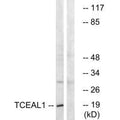 Western blot analysis of extracts from COLO cells, using TCEAL1 antibody.