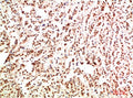 GAB1 Antibody – Figure 1 of 1