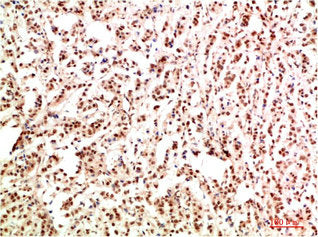 GAB1 Antibody – Figure 1 of 1