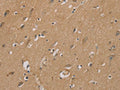 The image on the left is immunohistochemistry of paraffin-embedded Human brain tissue using CSB-PA248994(RAD51 Antibody) at dilution 1/40, on the right is treated with synthetic peptide. (Original magnification: ×200)
