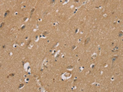 The image on the left is immunohistochemistry of paraffin-embedded Human brain tissue using CSB-PA248994(RAD51 Antibody) at dilution 1/40, on the right is treated with synthetic peptide. (Original magnification: ×200)