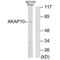 Western blot analysis of extracts from mouse brain cells, using AKAP10 antibody.