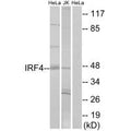 Western blot analysis of extracts from HeLa cells and Jurkat cells, using IRF4 antibody.