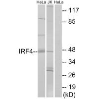 Western blot analysis of extracts from HeLa cells and Jurkat cells, using IRF4 antibody.