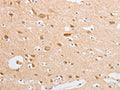 The image on the left is immunohistochemistry of paraffin-embedded Human brain tissue using CSB-PA250447(SERPINE2 Antibody) at dilution 1/20, on the right is treated with fusion protein. (Original magnification: ×200)