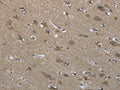 The image on the left is immunohistochemistry of paraffin-embedded Human brain tissue using CSB-PA250474(SYT3 Antibody) at dilution 1/50, on the right is treated with fusion protein. (Original magnification: ×200)