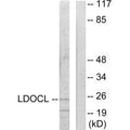 Western blot analysis of extracts from COLO205 cells, using LDOCL antibody.