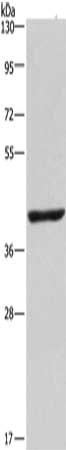 Gel: 10%SDS-PAGE, Lysate: 40 ug, Lane: 293T cells, Primary antibody: CSB-PA250757(NME7 Antibody) at dilution 1/300, Secondary antibody: Goat anti rabbit IgG at 1/8000 dilution, Exposure time: 2 minutes