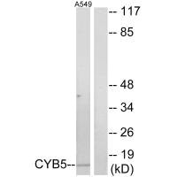 Western blot analysis of extracts from A549 cells, using CYB5 antibody.