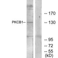 Western blot analysis of extracts from 293 cells, using PKCB1 antibody.