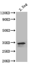 Western Blot
Positive WB detected in: recombinant protein
All lanes: beta-Spec Antibody at 1:1000
Secondary
Goat polyclonal to rabbit IgG at 1/50000 dilution
Predicted band size: 35.4 kDa
Observed band size: 35.4 kDa
