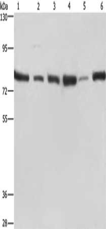 Gel: 6%SDS-PAGE, Lysate: 40 ug, Lane 1-6: Jurkat cells, 293T cells, Hela cells, K562 cells, human testis tissue, A549 cells, Primary antibody: CSB-PA252235(SIRT1 Antibody) at dilution 1/500, Secondary antibody: Goat anti rabbit IgG at 1/8000 dilution, Exposure time: 20 seconds