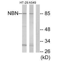 Western blot analysis of extracts from HT-29 cells and A549 cells, using NBN antibody.
