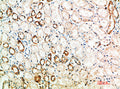 Immunohistochemical analysis of paraffin-embedded human-kidney, antibody was diluted at 1:200