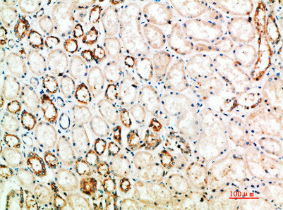 Immunohistochemical analysis of paraffin-embedded human-kidney, antibody was diluted at 1:200