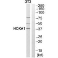 Western blot analysis of extracts from COLO cells,   HeLa/ cells and 293 cells, using HOXA1 antibody.
