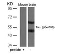 Western blot analysis of extracts from mouse brain tissue using Tau(Phospho-Ser356) Antibody and the same antibody preincubated with blocking peptide.