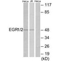 Western blot analysis of extracts from HeLa/Jurkat cells, using EGR1/2 antibody.