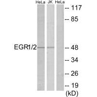 Western blot analysis of extracts from HeLa/Jurkat cells, using EGR1/2 antibody.