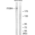 Western blot analysis of extracts from HepG2 cells, treated with PMA (125ng/ml, 30mins), using ITGB4 (Ab-1510) antibody.