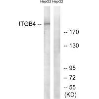 Western blot analysis of extracts from HepG2 cells, treated with PMA (125ng/ml, 30mins), using ITGB4 (Ab-1510) antibody.