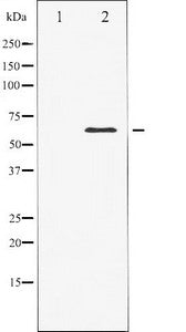 Western blot analysis of Elk1 expression in heatshock treated HeLa whole cell lysates,The lane on the left is treated with the antigen-specific peptide.