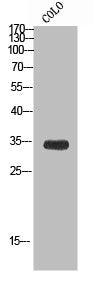 Western blot analysis of CoLo using TCEAL6 antibody.. Secondary antibody  was diluted at 1:20000