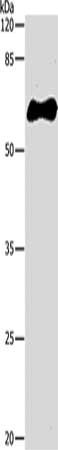 Gel: 10%SDS-PAGE, Lysate: 2 ug, Lane: Recombinant GST tag protein, Primary antibody: CSB-PA255432(GST Tag Antibody) at dilution 1/1000, Secondary antibody: Goat anti rabbit IgG at 1/8000 dilution, Exposure time: 15 seconds