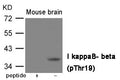 Western blot analysis of extracts from  Mouse brain tissue using IkappaB- beta (Phospho-Thr19) Antibody.The lane on the left is treated with the antigen-specific peptide.