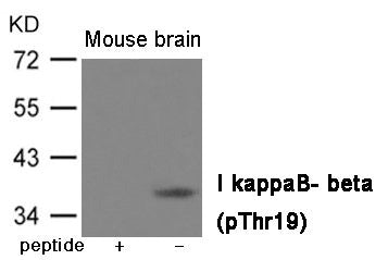 Western blot analysis of extracts from  Mouse brain tissue using IkappaB- beta (Phospho-Thr19) Antibody.The lane on the left is treated with the antigen-specific peptide.