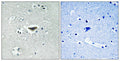 Immunohistochemical analysis of paraffin-embedded human brain tissue using Ras-GRF1 (Phospho-Ser916) antibody (left)or the same antibody preincubated with blocking peptide (right).