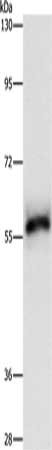 Gel: 8%SDS-PAGE, Lysate: 40 ug, Lane: Hela cells, Primary antibody: CSB-PA257126(HCK Antibody) at dilution 1/500, Secondary antibody: Goat anti rabbit IgG at 1/8000 dilution, Exposure time: 15 seconds