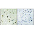 Immunohistochemistry analysis of paraffin-embedded human brain tissue, using MAD4 antibody.