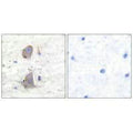 Immunohistochemical analysis of paraffin-embedded human brain tissue using GLUT1 antibody.