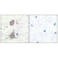Immunohistochemical analysis of paraffin-embedded human brain tissue using GLUT1 antibody.