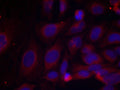 Immunofluorescence staining of methanol-fixed HeLa cells using NF-kappa;B p105 (phospho-Ser893) antibody.