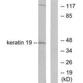 Western blot analysis of extracts from LOVO cells, using Keratin 19 antibody.