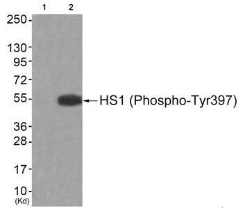 Western blot analysis of extracts from JK cells (Lane 2), using HS1 (Phospho-Tyr397) Antibody.The lane on the left is treated with antigen-specific peptide.