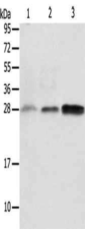 Gel: 12%SDS-PAGE, Lysate: 40 ug, Lane 1-3: Human fetal liver tissue, Human seminoma tissue, RAW264.7 cells, Primary antibody: CSB-PA259131(ALKBH2 Antibody) at dilution 1/650, Secondary antibody: Goat anti rabbit IgG at 1/8000 dilution, Exposure time: 2 minutes