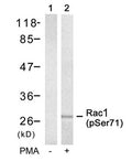 Western blot analysis of extracts from 293 cells untreated(lane 1) or treated with PMA(lane 2) using Rac1(Phospho-Ser71) Antibody.
